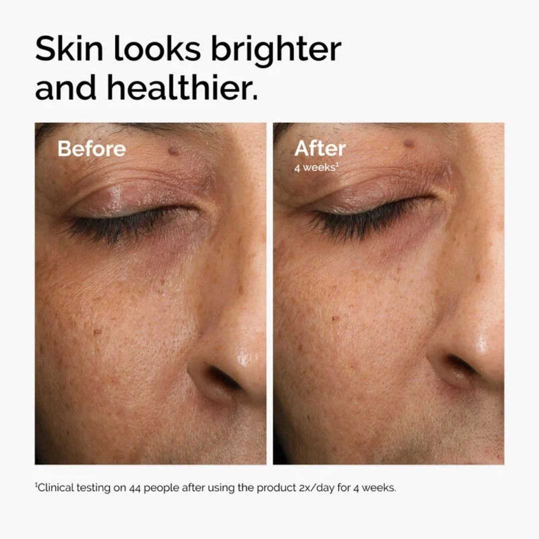 The Ordinary Multi-Antioxidant Radiance Serum - Image 4