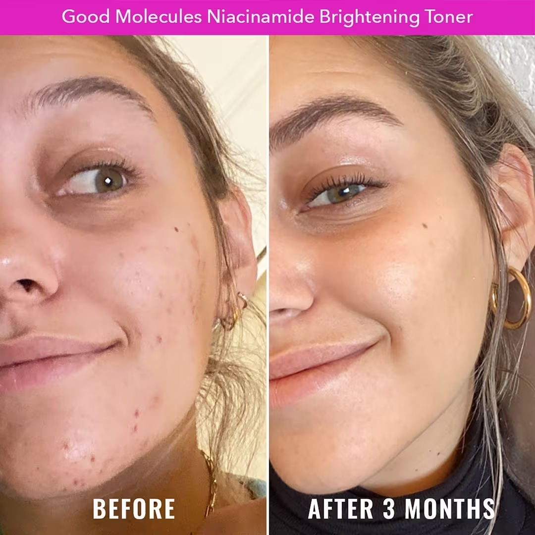 Good Molecules Niacinamide Brightening Toner - Image 4